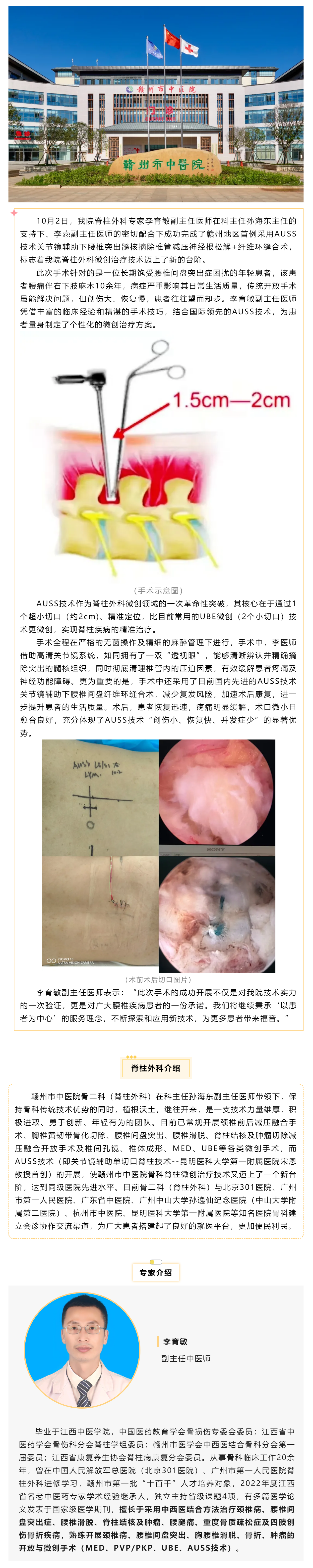 全市首例！我院成功實(shí)施AUSS技術(shù)關(guān)節(jié)鏡輔助下腰椎突出髓核摘除椎管減壓神經(jīng)根松解+纖維環(huán)縫合術(shù).png