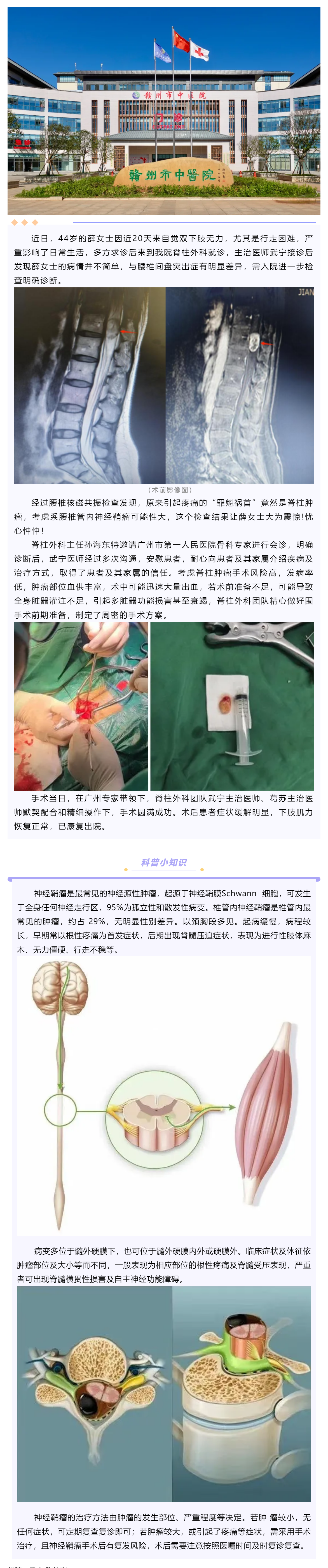 腰腿痛、下肢乏力麻木，提防神經(jīng)鞘瘤！.png